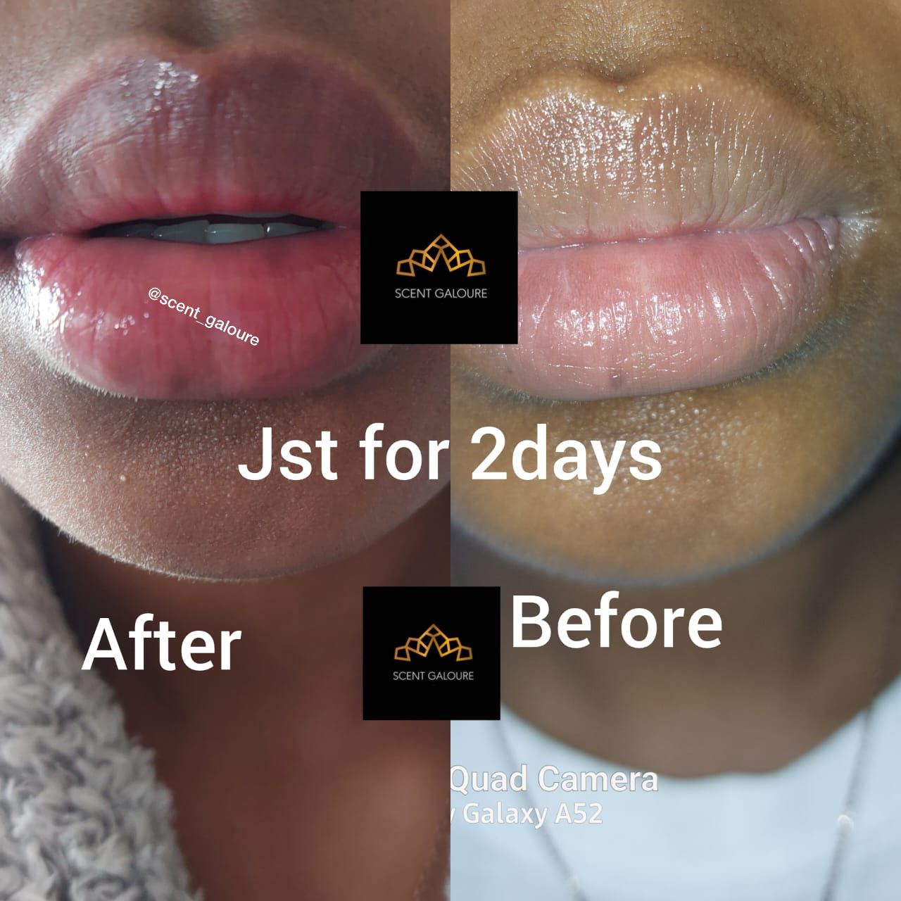 LIP BRIGHTENING COMBO