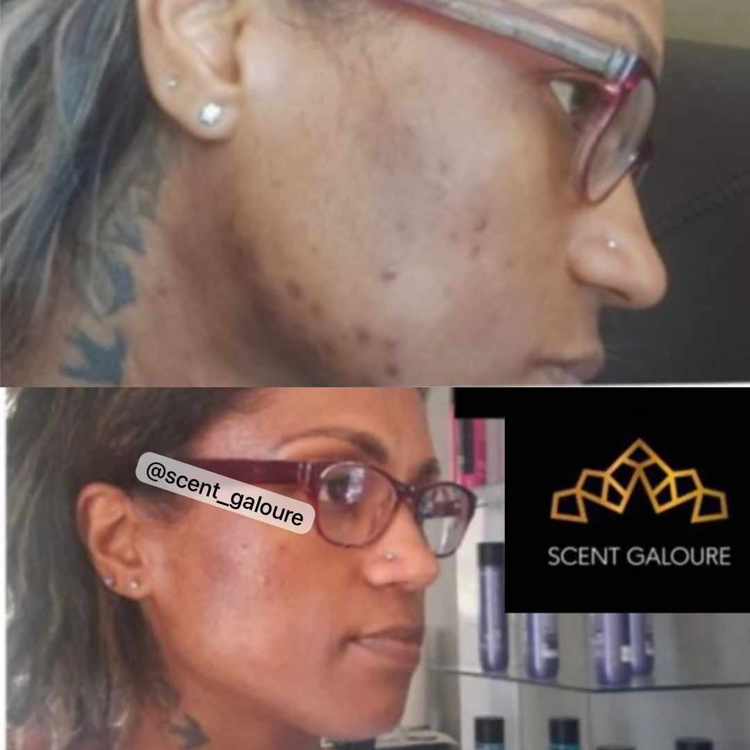 AfriGlow Face Soap Combo