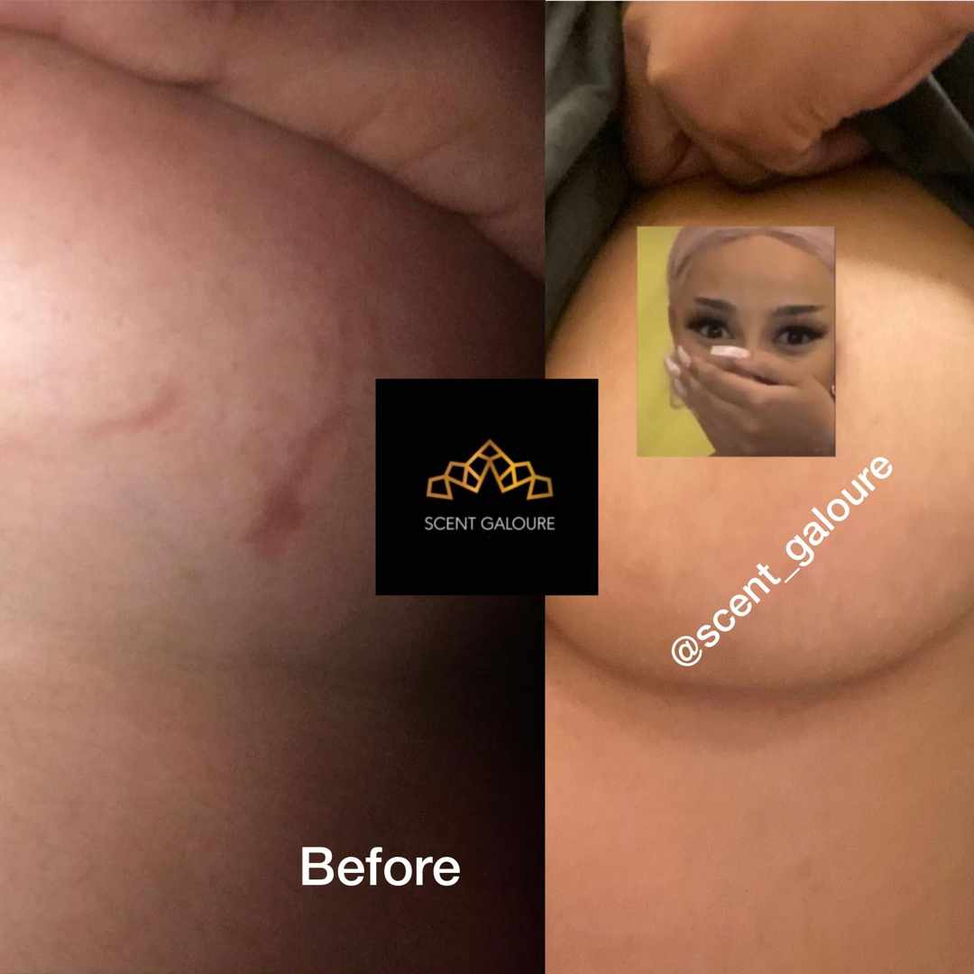 Body Corrector Glow Combo