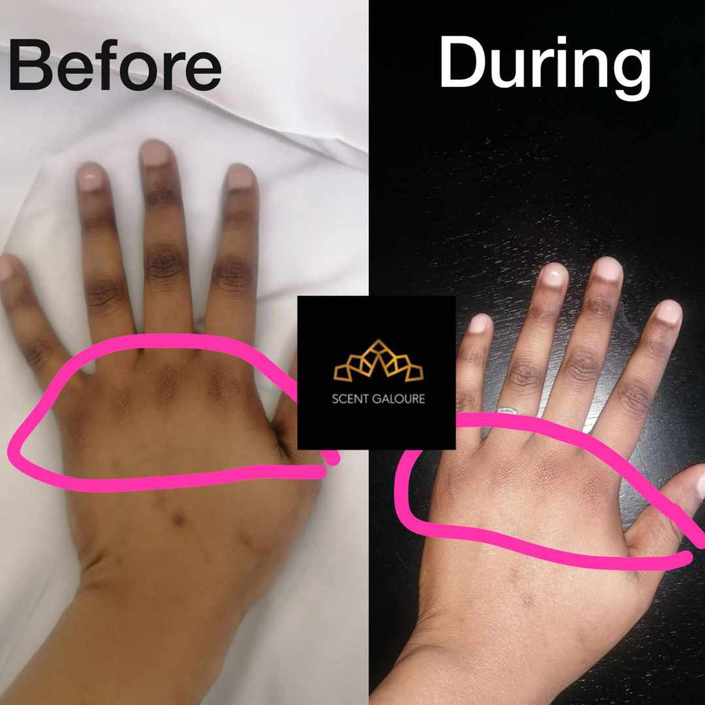 Hands & Knuckle Brightening Combo