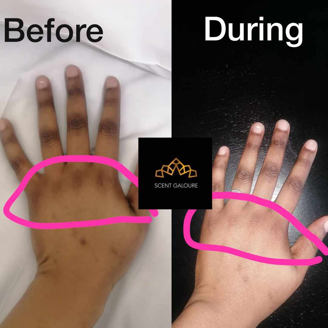 Hands & Knuckle Brightening Combo