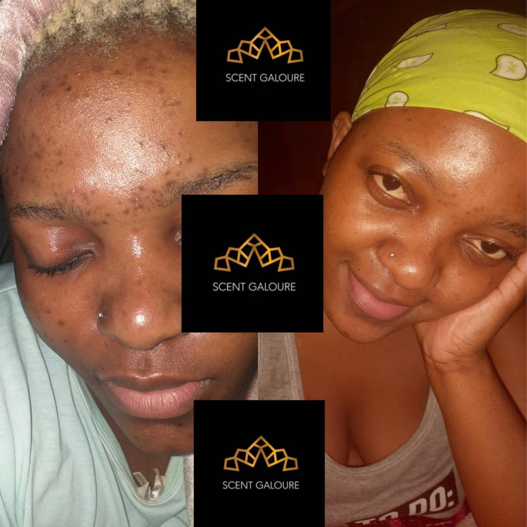 AfriGlow Face Soap Combo