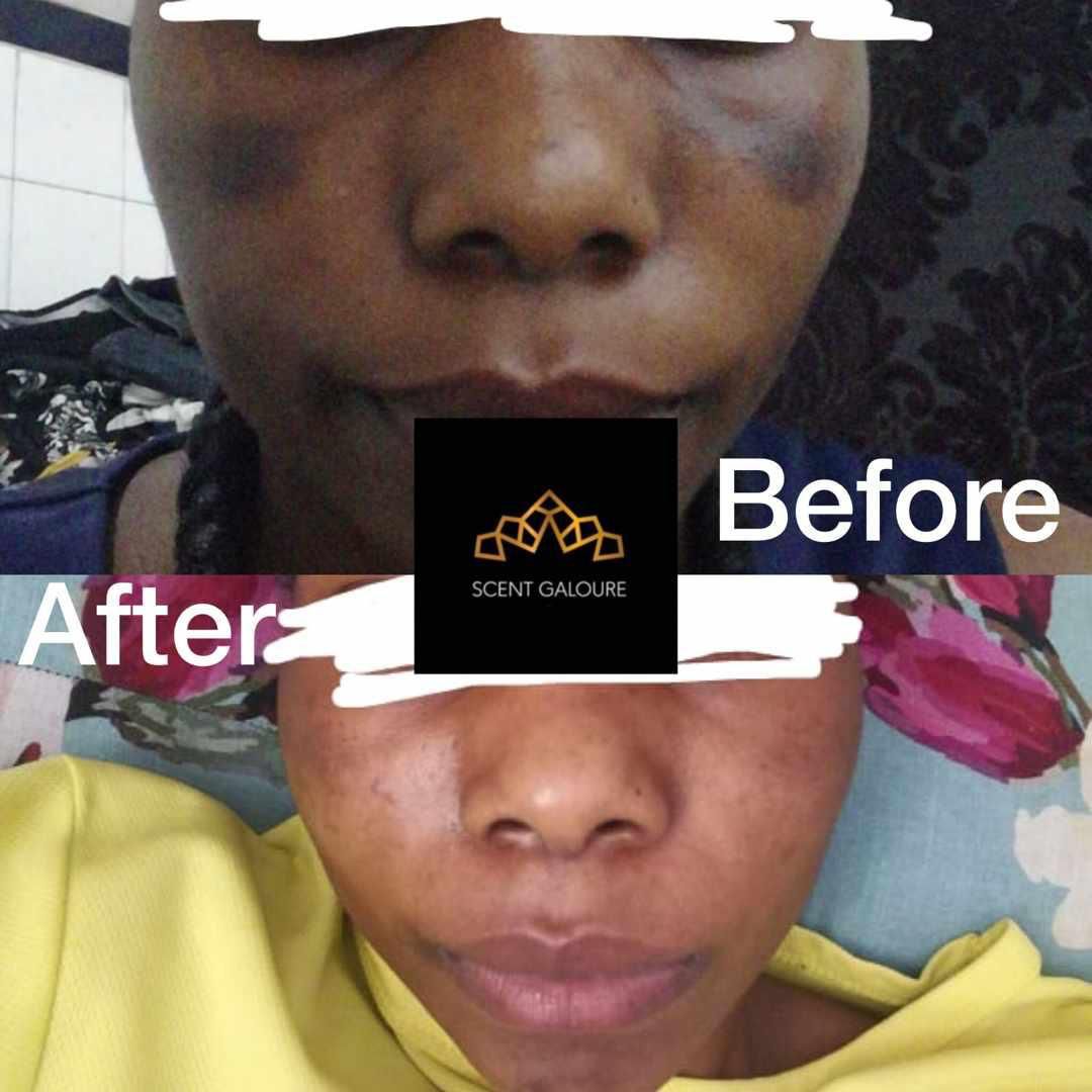 SERUM FACE GLOW COMBO