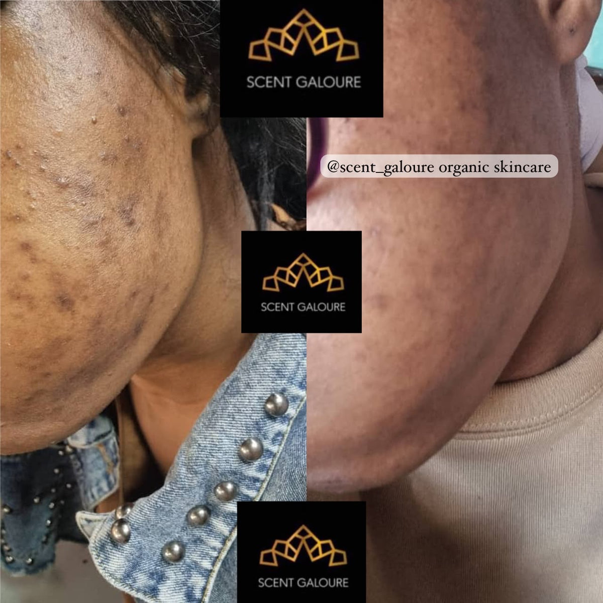 GLOW CREME FACE COMBO