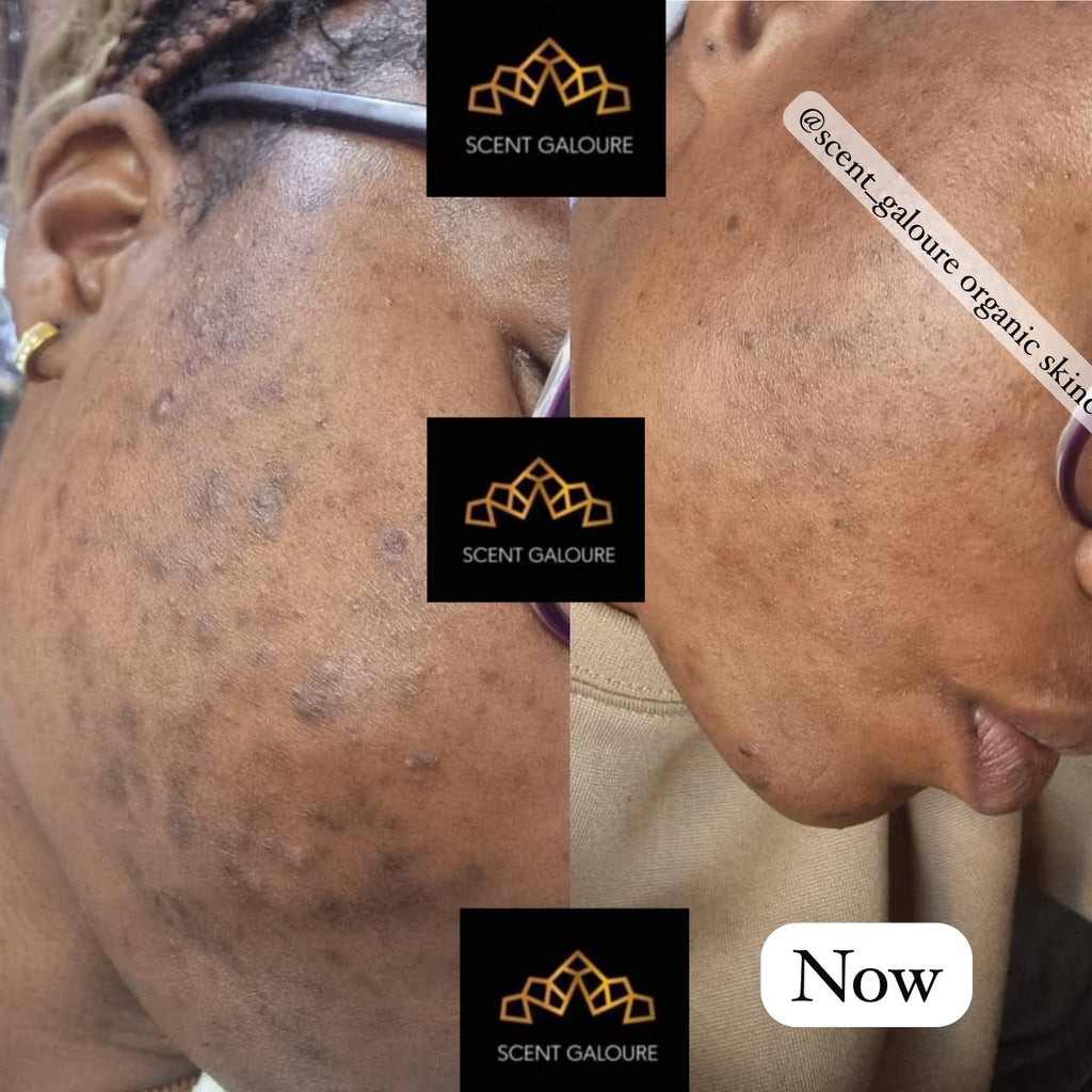 DERMA GLOW FACE COMBO