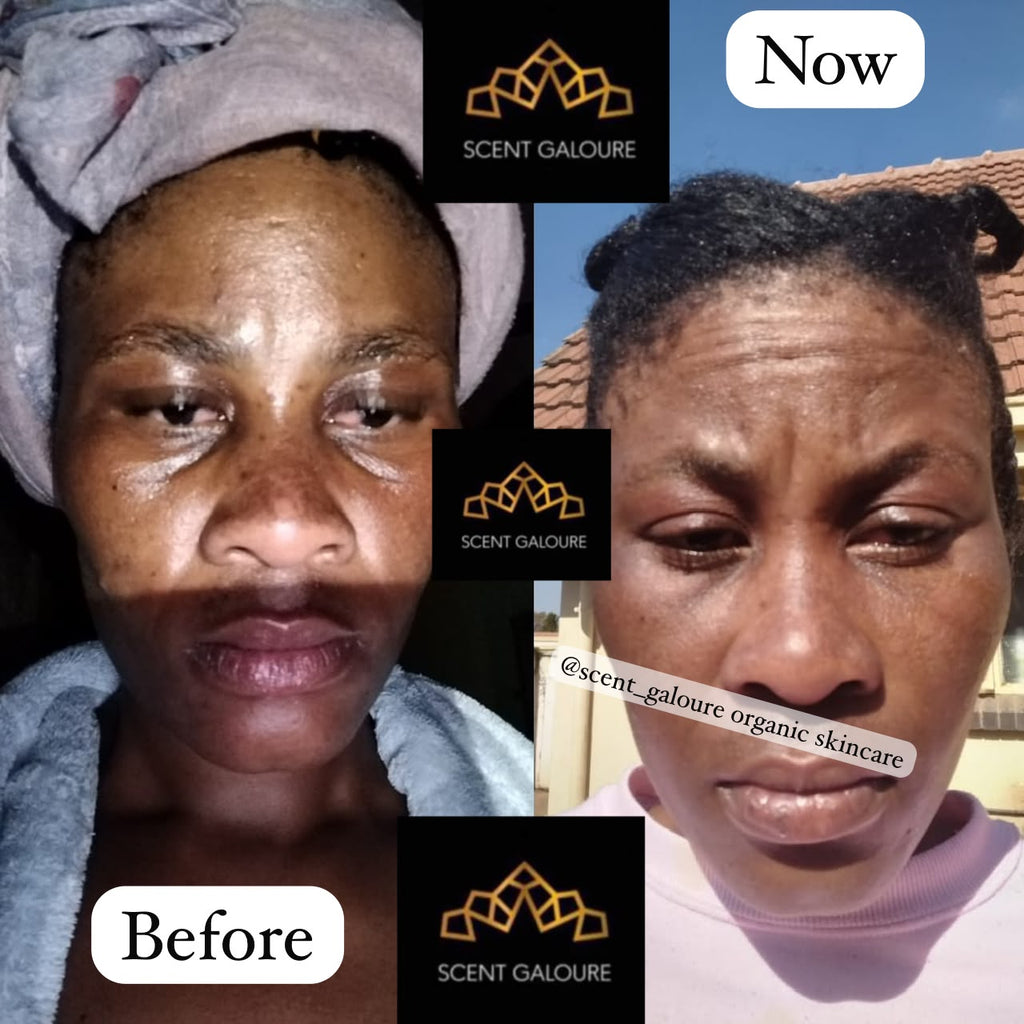 DERMA GLOW FACE COMBO