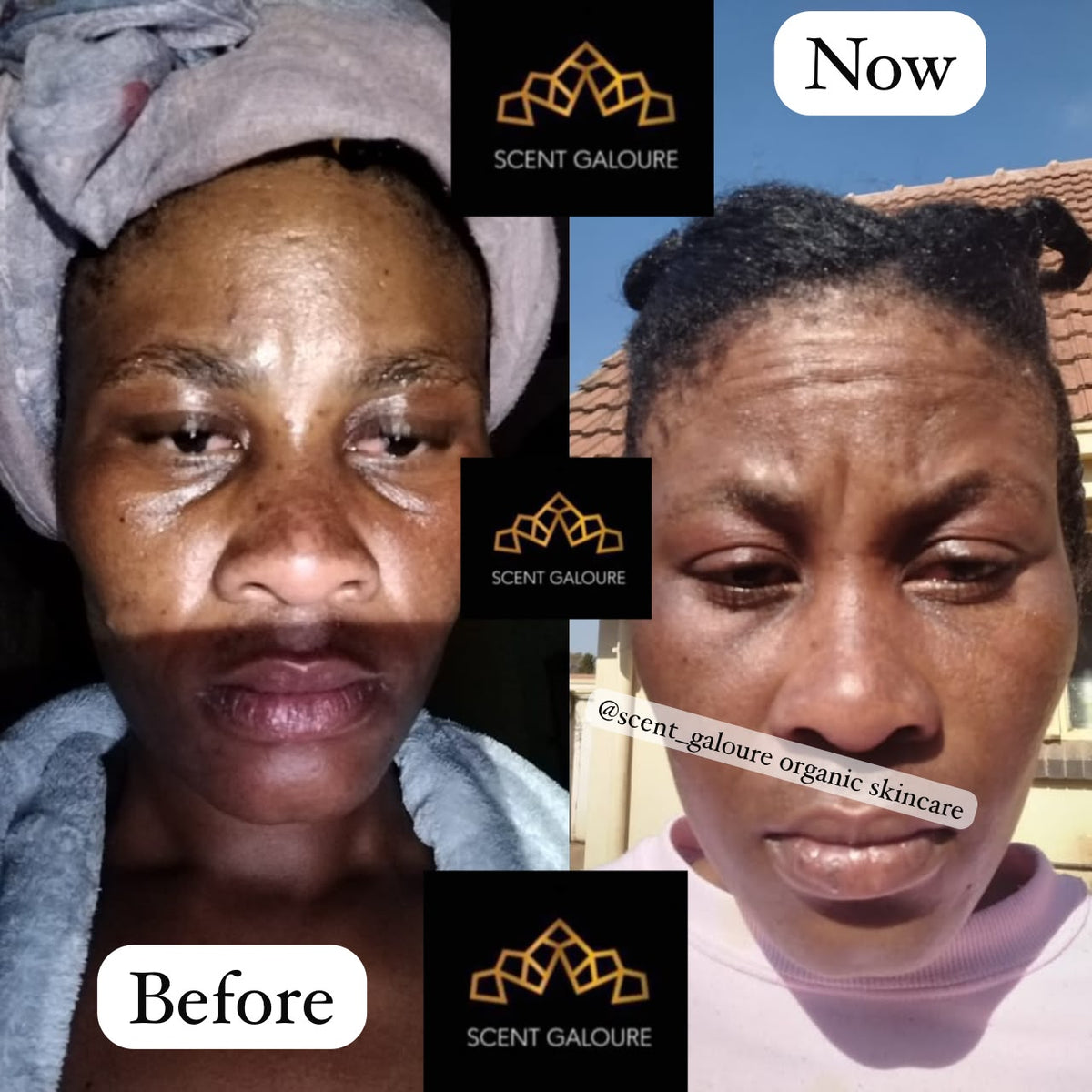 DERMA GLOW FACE COMBO