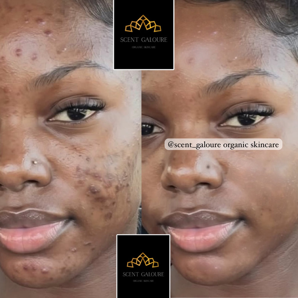 DERMA GLOW FACE COMBO