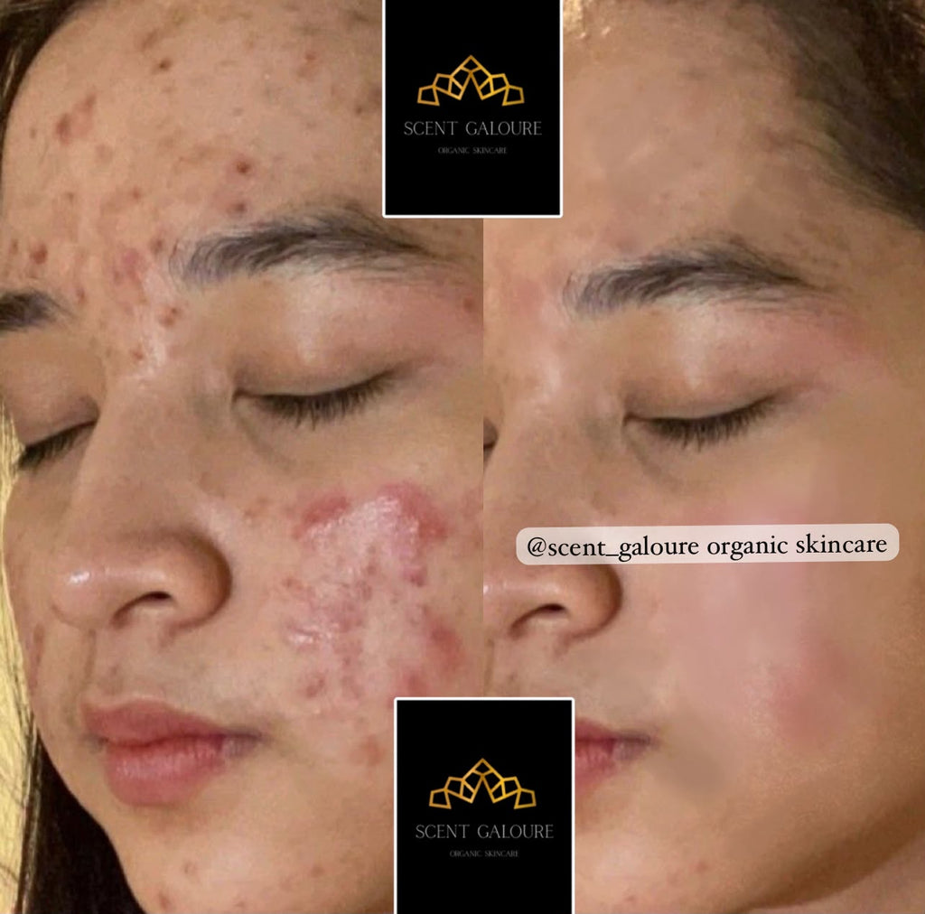 SERUM FACE GLOW COMBO