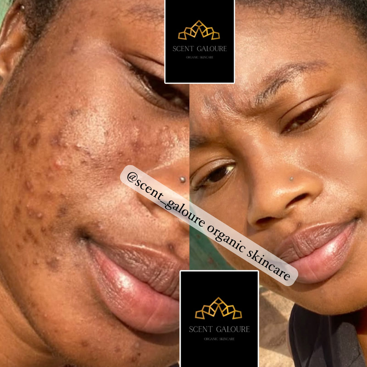 DERMA GLOW FACE COMBO