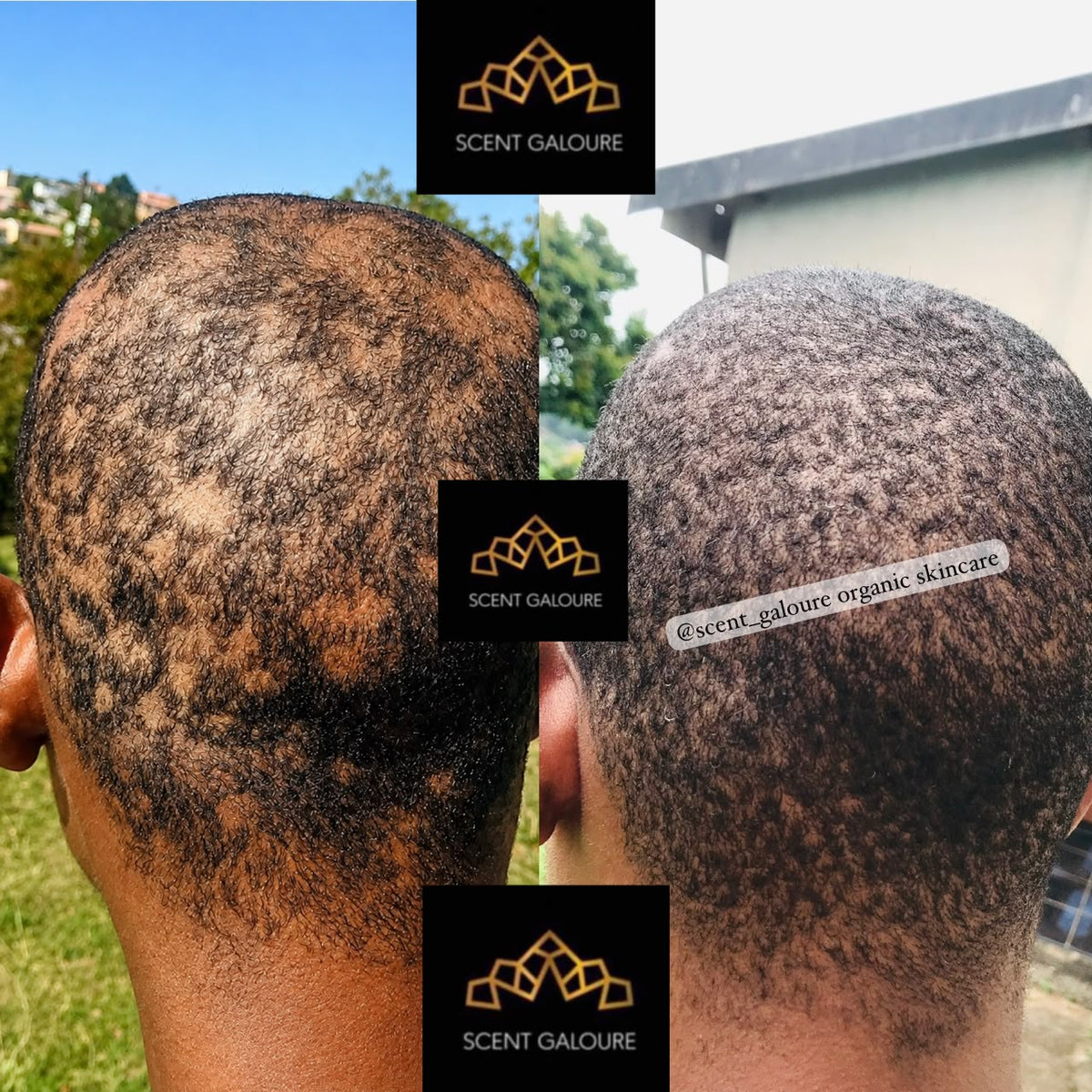 HAIR GROWTH & REPAIR COMBO